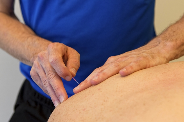 Dry Needling Wijk bij Duurstede